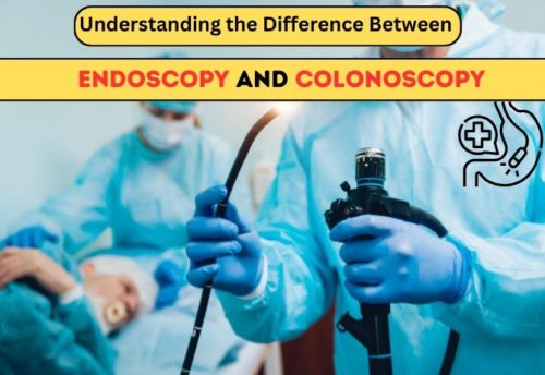 Understanding the Difference between Endoscopy and Colonoscopy