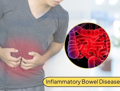 Inflammatory Bowel Disease