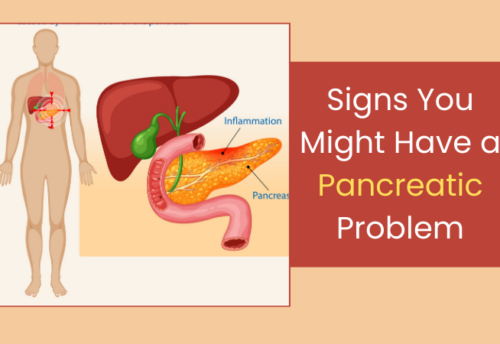 Signs You Might Have a Pancreatic Problem