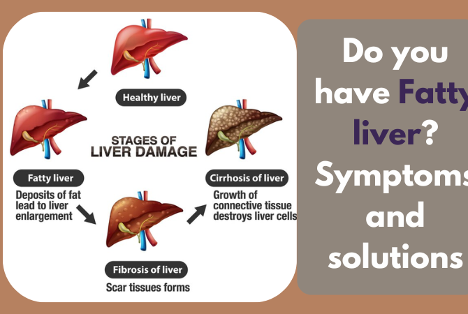 Do you have Fatty liver? Symptoms and solutions