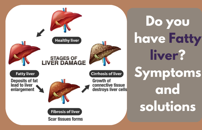 Do you have Fatty liver? Symptoms and solutions