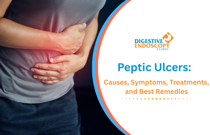 Peptic Ulcers Causes, Symptoms, Treatments, and Best Remedies
