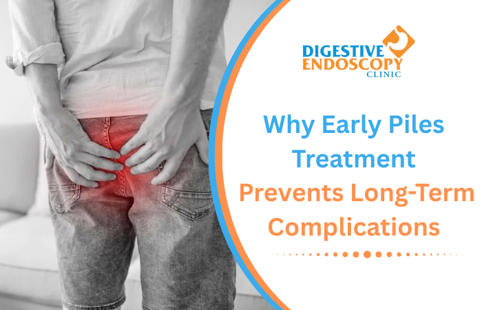 Why Early Piles Treatment Prevents Long-Term Complications