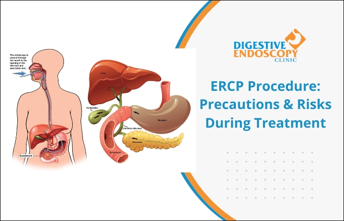 ERCP Procedure: Precautions & Risks