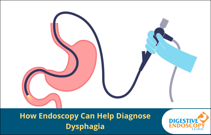 How Endoscopy Can Help Diagnose Dysphagia.