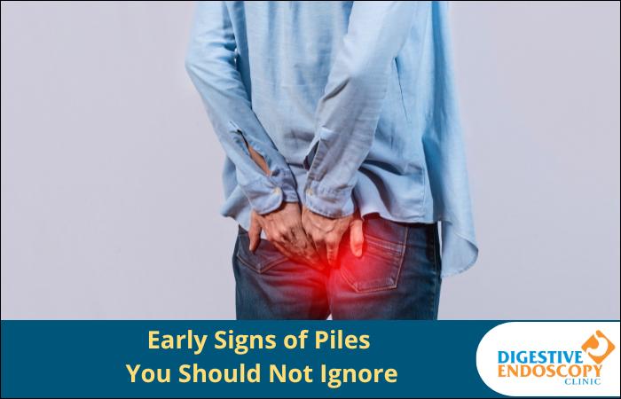 Early Signs of Piles You Should Not Ignore