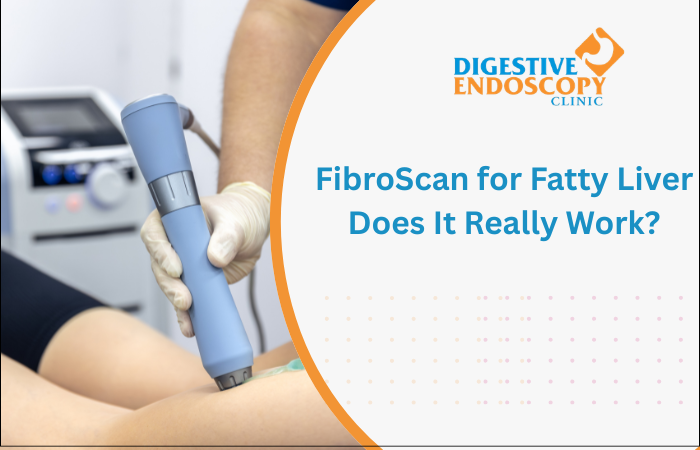 FibroScan